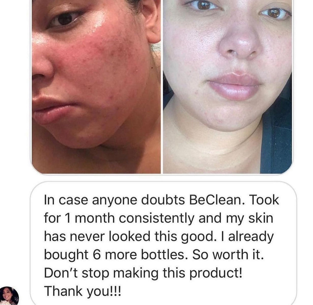 Be Clean
