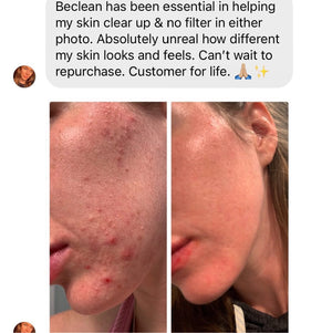 BeClean + BeTox Bundle